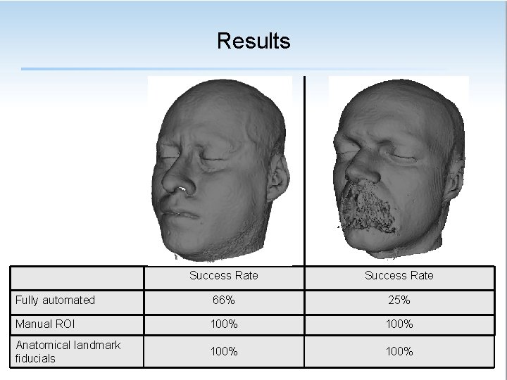 Results Success Rate Fully automated 66% 25% Manual ROI 100% Anatomical landmark fiducials 100%