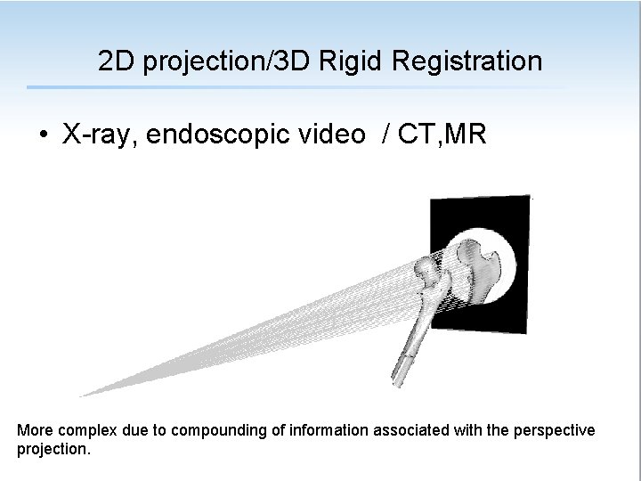 2 D projection/3 D Rigid Registration • X-ray, endoscopic video / CT, MR More