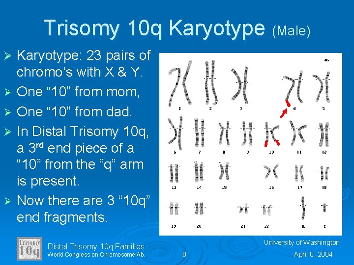 Trisomy 10 q Karyotype (Male) Karyotype: 23 pairs of chromo’s with X & Y.