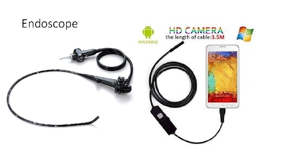 Endoscope 