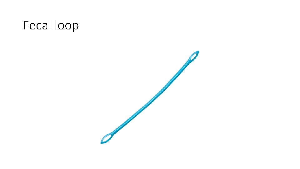 Fecal loop 