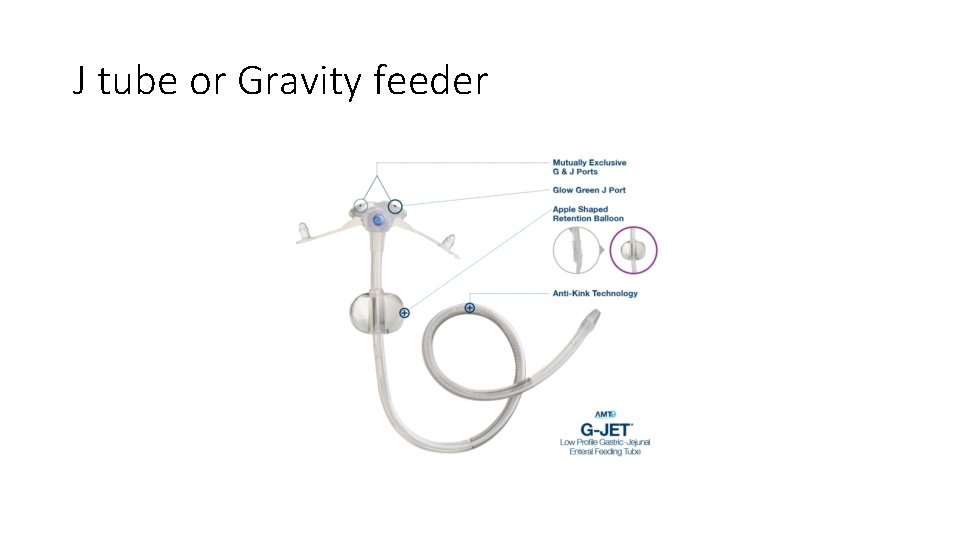 J tube or Gravity feeder 