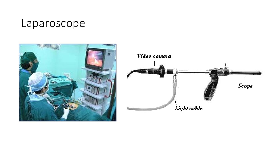 Laparoscope 