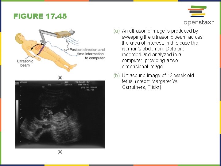 FIGURE 17. 45 (a) An ultrasonic image is produced by sweeping the ultrasonic beam