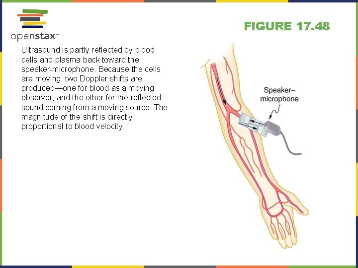 FIGURE 17. 48 Ultrasound is partly reflected by blood cells and plasma back toward