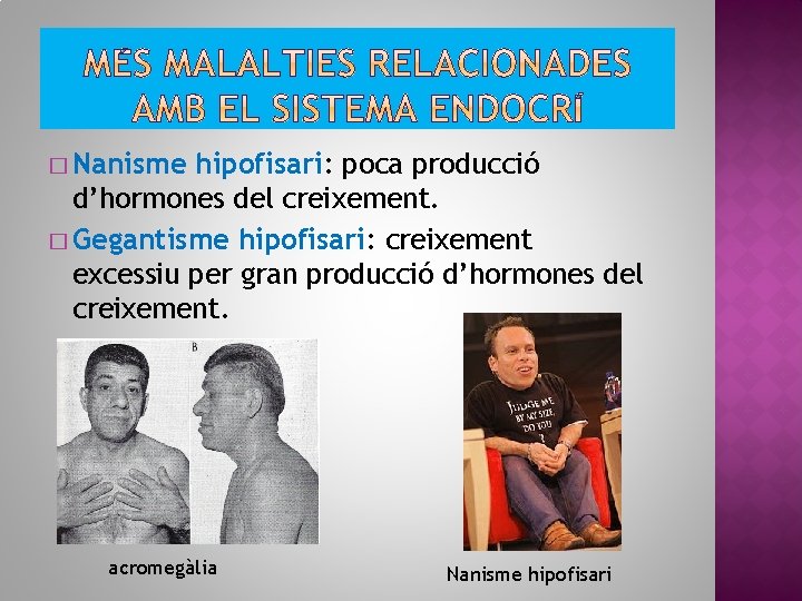 � Nanisme hipofisari: poca producció d’hormones del creixement. � Gegantisme hipofisari: creixement excessiu per