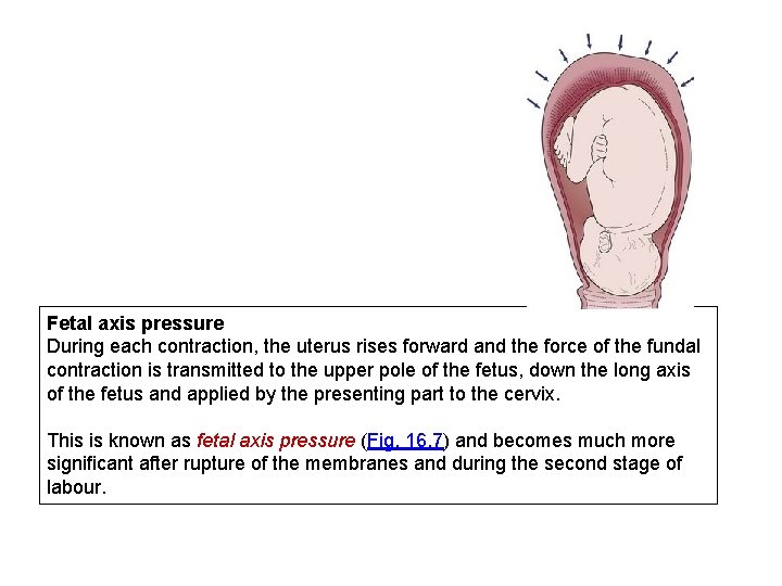 Fetal axis pressure During each contraction, the uterus rises forward and the force of
