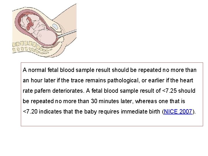 A normal fetal blood sample result should be repeated no more than an hour