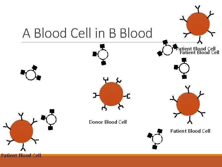 A Blood Cell in B Blood Patient Blood Cell Donor Blood Cell Patient Blood