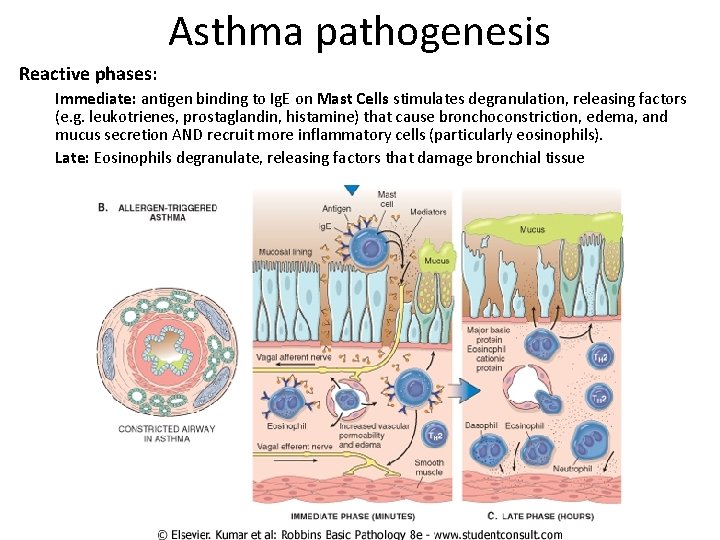 Asthma pathogenesis Reactive phases: Immediate: antigen binding to Ig. E on Mast Cells stimulates
