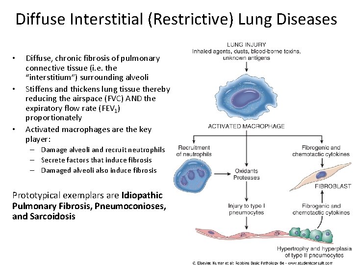 Diffuse Interstitial (Restrictive) Lung Diseases • • • Diffuse, chronic fibrosis of pulmonary connective
