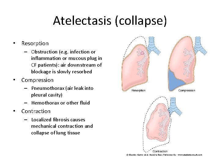 Atelectasis (collapse) • Resorption – Obstruction (e. g. infection or inflammation or mucous plug