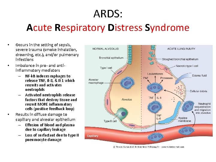 ARDS: Acute Respiratory Distress Syndrome • • Occurs in the setting of sepsis, severe