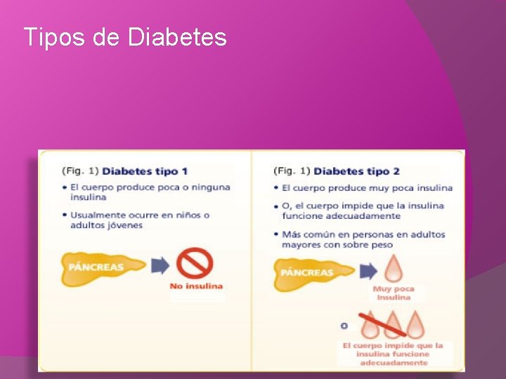 Tipos de Diabetes 