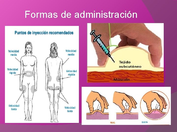 Formas de administración 