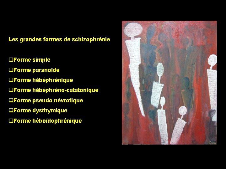 Les grandes formes de schizophrènie q. Forme simple q. Forme paranoïde q. Forme hébéphrénique