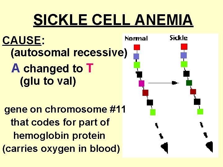 SICKLE CELL ANEMIA CAUSE: (autosomal recessive) A changed to T (glu to val) gene