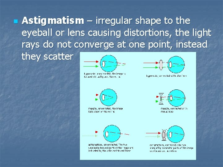 n Astigmatism – irregular shape to the eyeball or lens causing distortions, the light