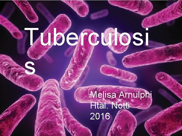 Tuberculosis s Andrea Carlucci Htal. Notti 2015 Melisa Arnulphi Htal. Notti 2016 