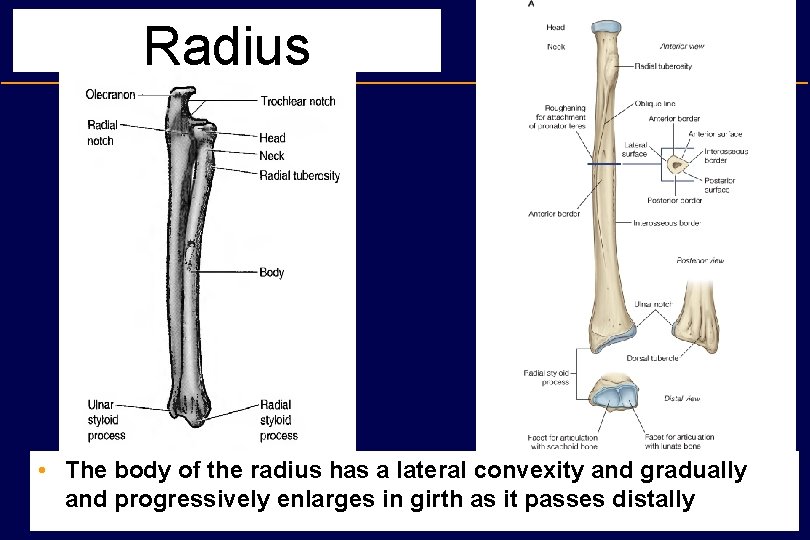 Radius • The body of the radius has a lateral convexity and gradually and