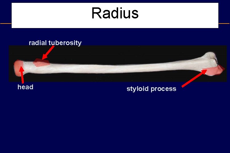 Radius radial tuberosity head styloid process 