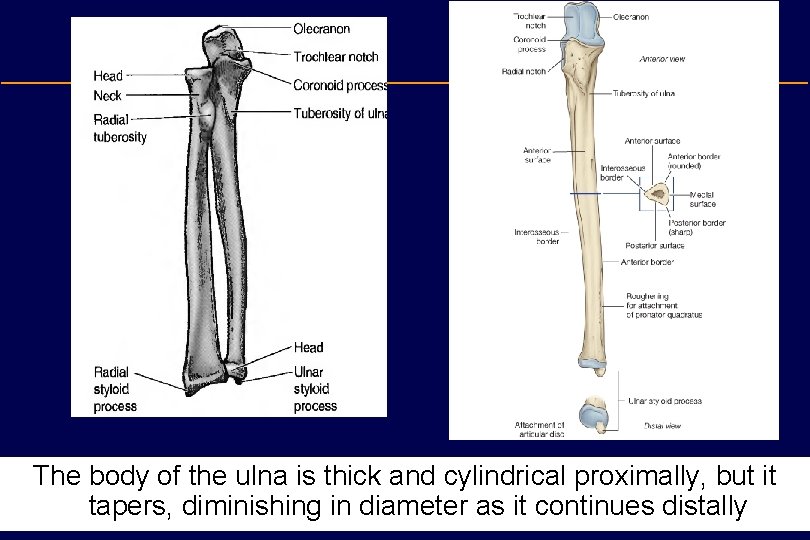 The body of the ulna is thick and cylindrical proximally, but it tapers, diminishing