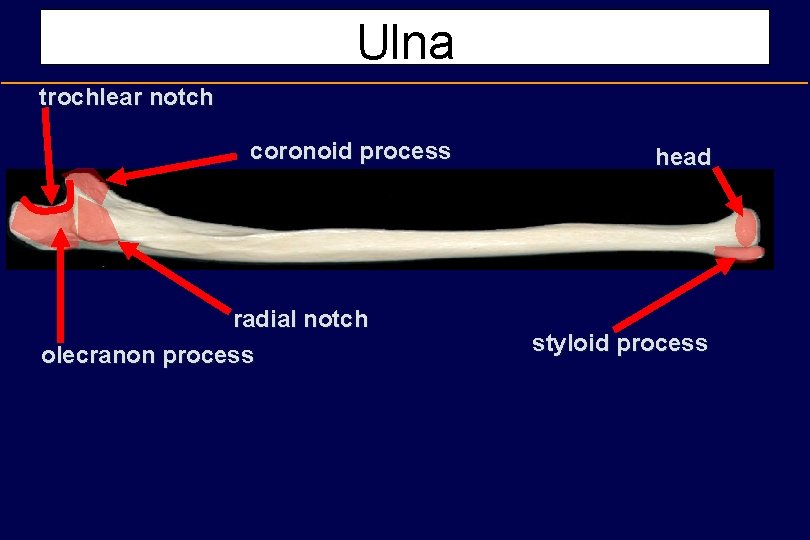 Ulna trochlear notch coronoid process radial notch olecranon process head styloid process 