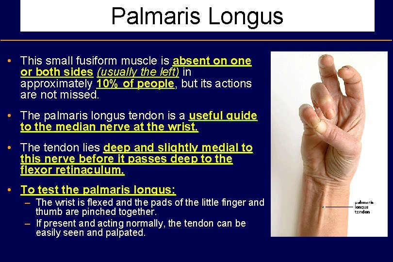 Palmaris Longus • This small fusiform muscle is absent on one or both sides