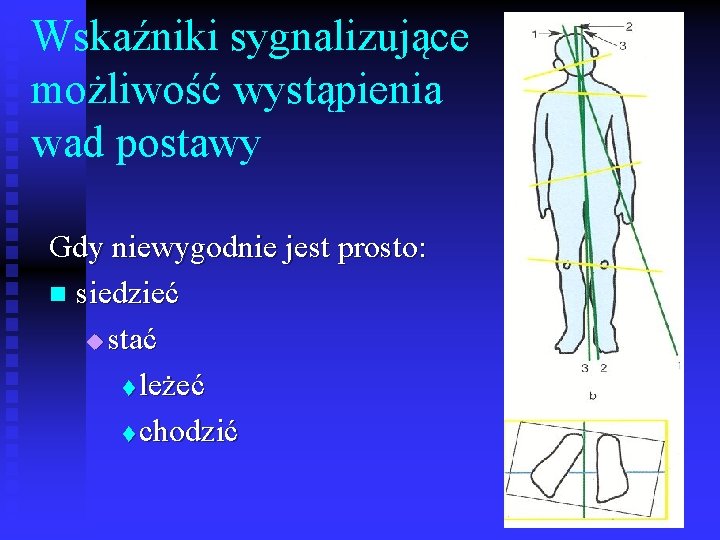 Wskaźniki sygnalizujące możliwość wystąpienia wad postawy Gdy niewygodnie jest prosto: n siedzieć u stać