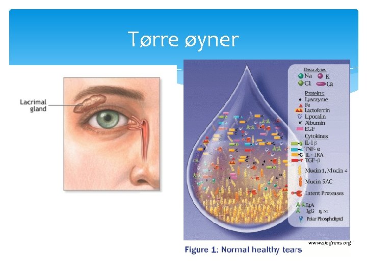 Tørre øyner www. sjogrens. org 