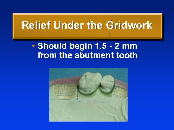 Relief Under the Gridwork • Should begin 1. 5 - 2 mm from the