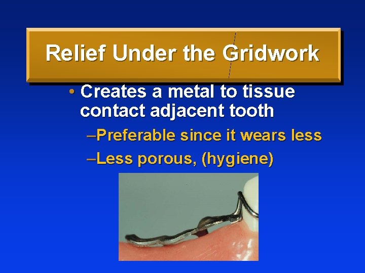 Relief Under the Gridwork • Creates a metal to tissue contact adjacent tooth –Preferable