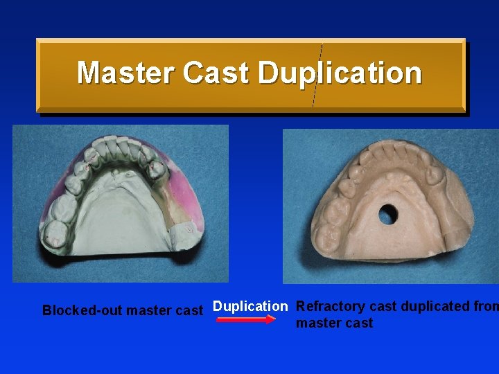 Master Cast Duplication Blocked-out master cast Duplication Refractory cast duplicated from master cast 