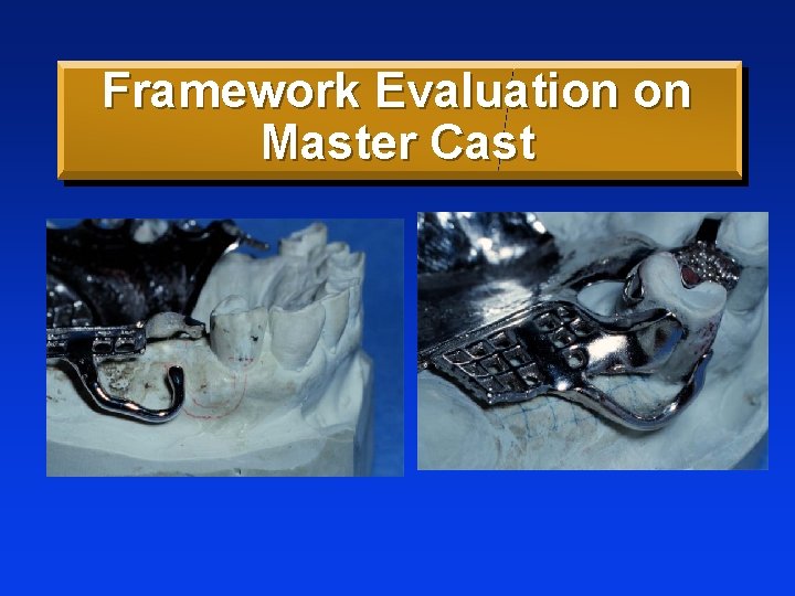 Framework Evaluation on Master Cast 