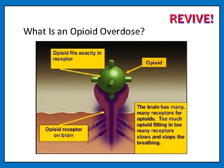 What Is an Opioid Overdose? Opioid 