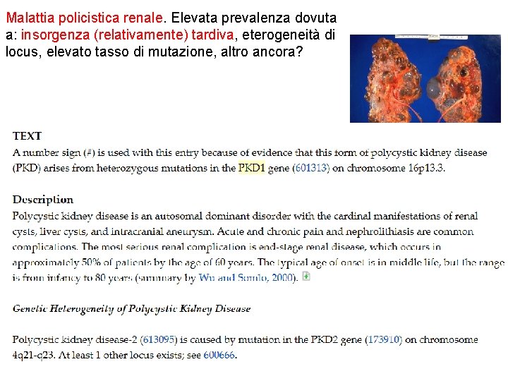 Malattia policistica renale. Elevata prevalenza dovuta a: insorgenza (relativamente) tardiva, eterogeneità di locus, elevato Malattia policistica renale. Elevata prevalenza dovuta a: insorgenza (relativamente) tardiva, eterogeneità di locus, elevato