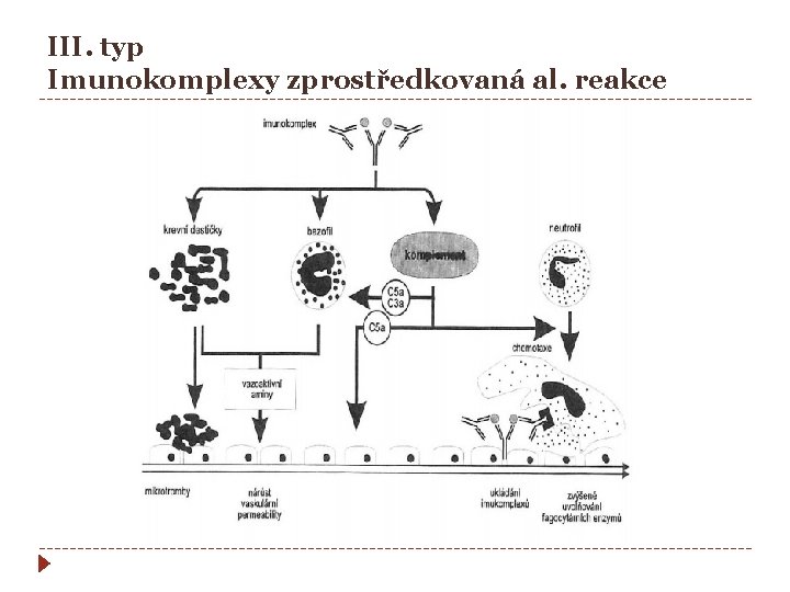 III. typ Imunokomplexy zprostředkovaná al. reakce 