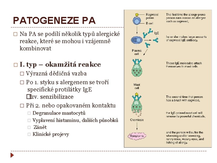 PATOGENEZE PA � Na PA se podílí několik typů alergické reakce, které se mohou