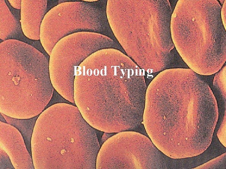 Blood Typing 