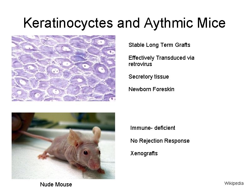 Keratinocyctes and Aythmic Mice Stable Long Term Grafts Effectively Transduced via retrovirus Secretory tissue