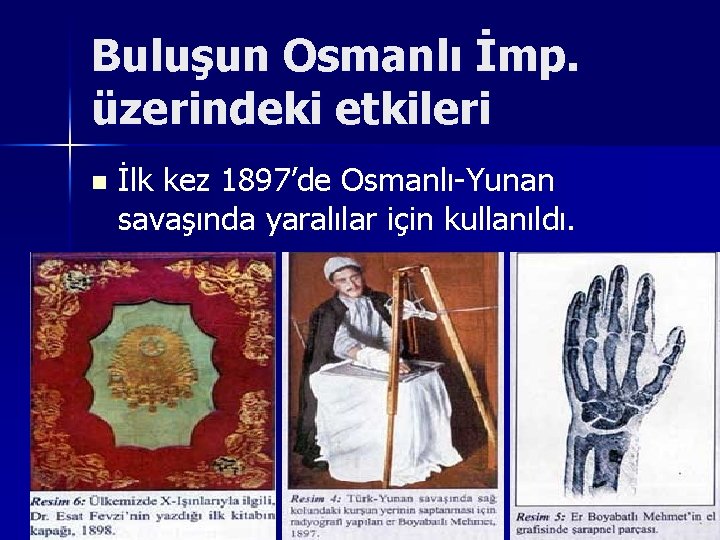 Buluşun Osmanlı İmp. üzerindeki etkileri n İlk kez 1897’de Osmanlı-Yunan savaşında yaralılar için kullanıldı.