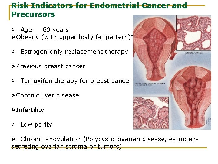 Risk Indicators for Endometrial Cancer and Precursors Ø Age 60 years ØObesity (with upper