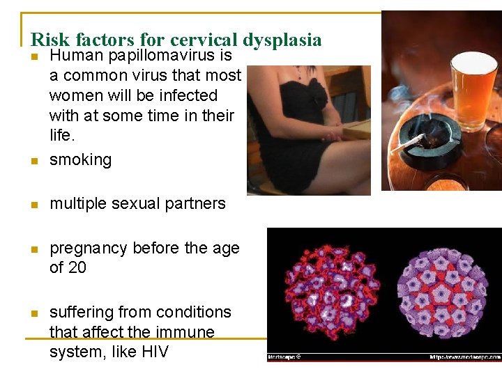 Risk factors for cervical dysplasia n Human papillomavirus is a common virus that most