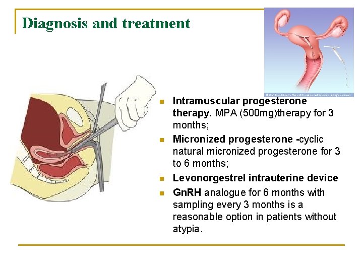 Diagnosis and treatment n n Intramuscular progesterone therapy. MPA (500 mg)therapy for 3 months;