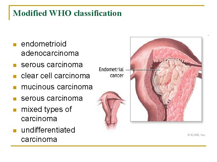 Modified WHO classification n n n endometrioid adenocarcinoma serous carcinoma clear cell carcinoma mucinous