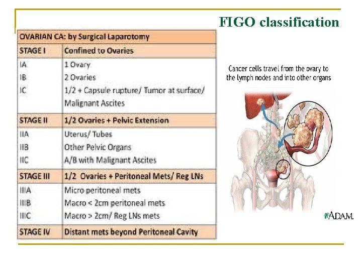 FIGO classification FIGO classification