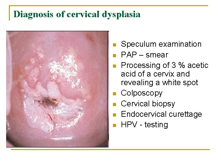 Diagnosis of cervical dysplasia n n n n Speculum examination PAP – smear Processing
