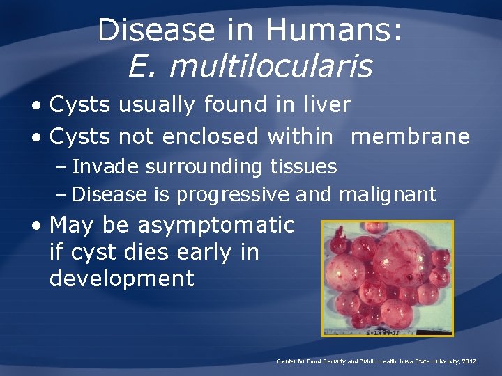 Disease in Humans: E. multilocularis • Cysts usually found in liver • Cysts not