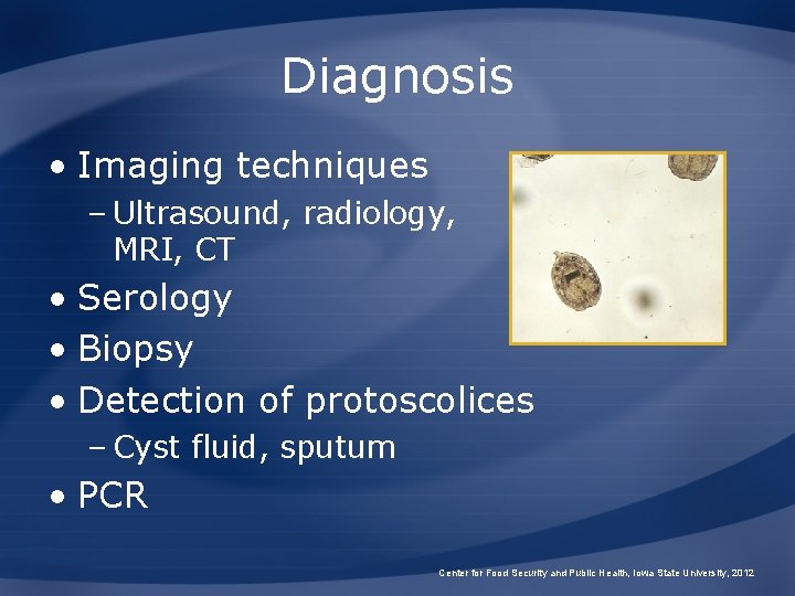 Diagnosis • Imaging techniques – Ultrasound, radiology, MRI, CT • Serology • Biopsy •
