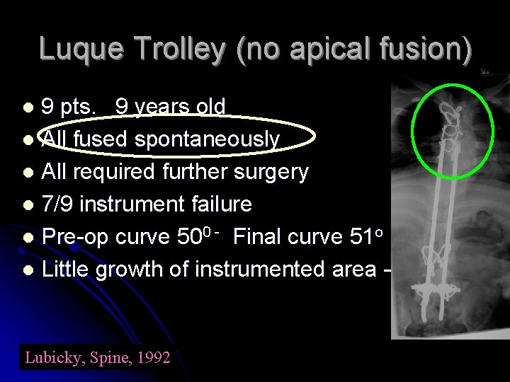 Luque Trolley (no apical fusion) 9 pts. 9 years old l All fused spontaneously Luque Trolley (no apical fusion) 9 pts. 9 years old l All fused spontaneously